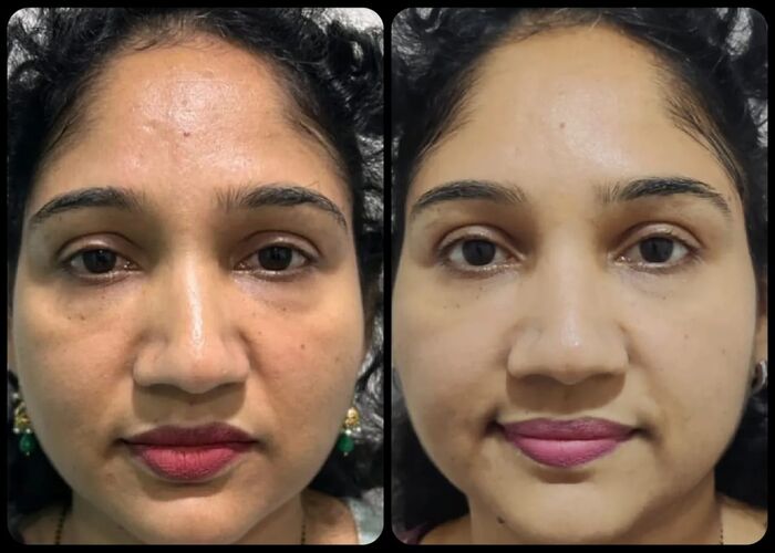 Wiki Special Skin Polish