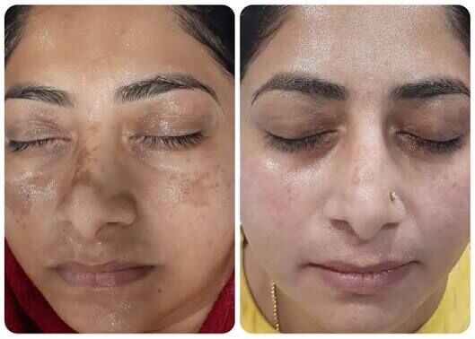 Wiki Special Skin Polish