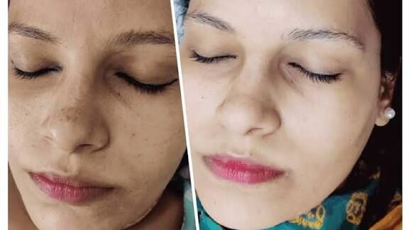 Wiki Special Skin Polish